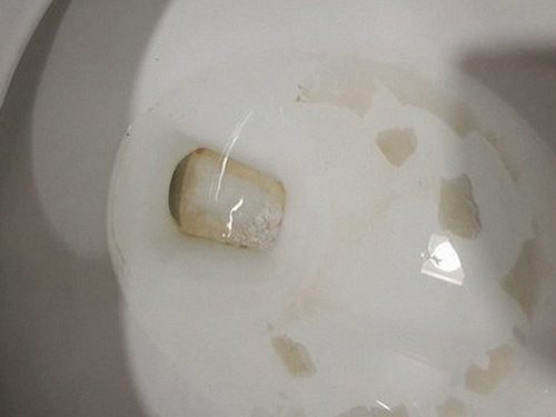 천호동 하수구막힘 여러 배수구의 물 높이를 비교해 배관 상태를 가늠하는 점검 장면